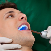 Restorations (Fillings)