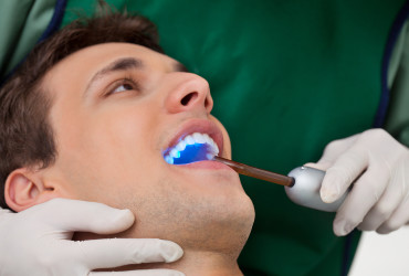 Restorations (Fillings)