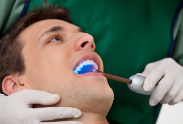 Restorations (Fillings)