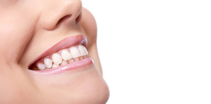 Teeth Whitening